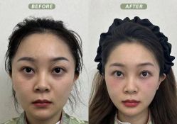 点击看大图 -Yestar艺星医疗美容医院