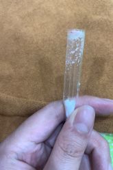 体验后-苗医生专业祛痘·皮肤管理