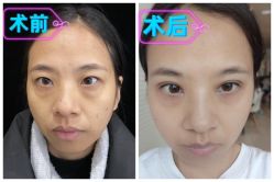 -素美医疗美容·西南眼鼻整形·修复基地