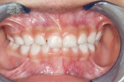 -青苗儿童口腔(长楹天街购物中心)