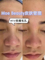-MOE BEAUTY.皮肤管理中心