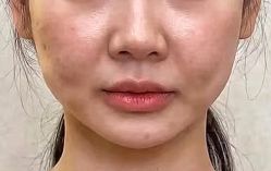 -天津健丽·去眼袋医疗美容机构