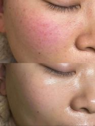 点击看大图 -蘭FACE·海菲秀飞顿Med SPA