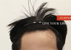 -大麦微针植发全国连锁