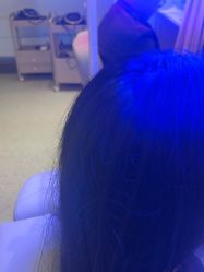 -碧莲盛·脱发养发中心