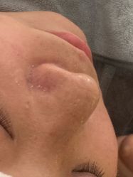 -skin79皮肤管理中心