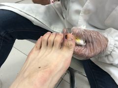 -新甲连锁灰指甲·甲沟炎·鸡眼(黑龙江路店)