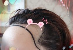 -大麦微针植发全国连锁