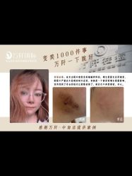 -万阡国际专业祛斑·祛痣·祛疤连锁