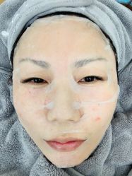 体验后-禾美嘉医疗美容