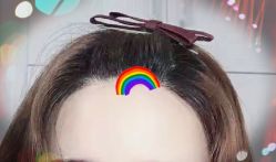 -大麦微针植发全国连锁