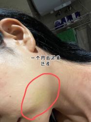 体验后-上海时光整形外科医院