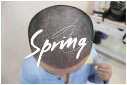 -大麦微针植发全国连锁