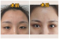-素美医疗美容·西南眼鼻整形·修复基地