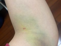 -广州仁爱天河医院体检中心