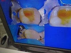 -美酷口腔牙齿矫正(江桥万达店)