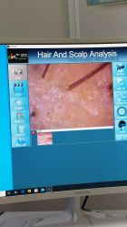 -雍禾植发全国连锁