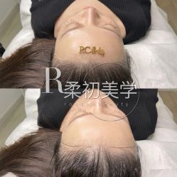 -RC半永久纹眉纹发际线