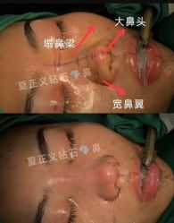 -北京米扬丽格医疗美容·联合丽格鼻整形中心