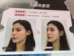 -Yestar艺星医疗美容医院