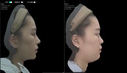 体验前-深圳广和门诊部·整形医疗美容