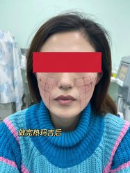 -八大处整形