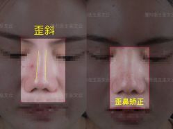 -北京米扬丽格医疗美容·联合丽格鼻整形中心