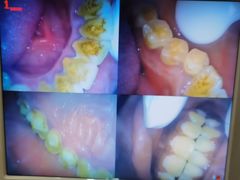 -赫尔森口腔·牙齿种植修复