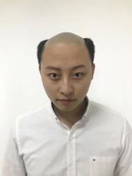 -发饰美男士增发补发假发定制店