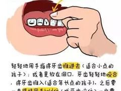-团圆口腔·种植中心(锦江院区)