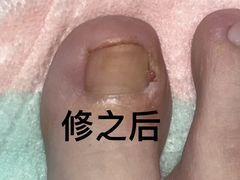 -郑远元专业修脚房·按摩·肉刺·灰指甲(东安路店)