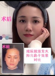 -广州美莱医疗美容医院