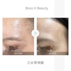 -Boss H Beauty美肌中心