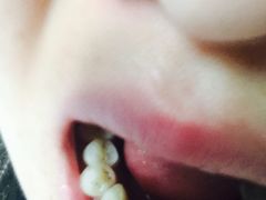 -爱贝口腔·牙周诊疗·种植修复中心