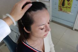 -大麦微针植发丨全国连锁