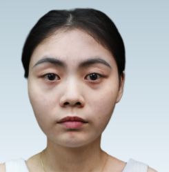 体验前-上海伊莱美医疗美容医院