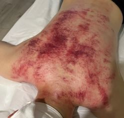 -阅年轻·AI家庭健康体质调理