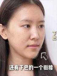 -Yestar重庆艺星医疗美容医院