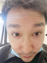 -海涛医疗美容·面部抗衰·注射美鼻