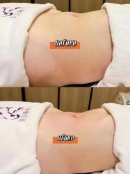 -Fundi张玉珊修身堂·indiba·BTL科技瘦身