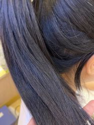 体验后-熙朵美学植发·连锁品牌