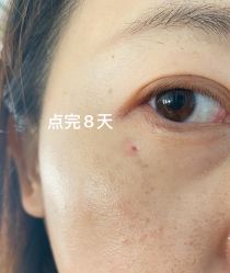 -小忠丽格医美