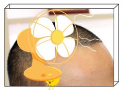 -大麦微针植发全国连锁