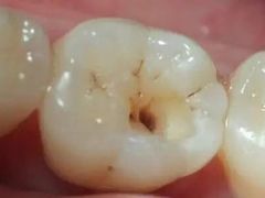 -欢乐口腔(望京分院)