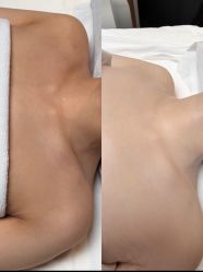 -ANNIL安奈尔·NASX超透白·科技抗衰·问题性肌肤管理