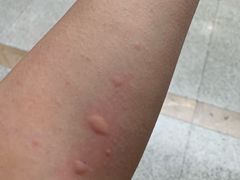 -大连市皮肤病医院