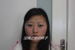 -成都西区医院整形美容