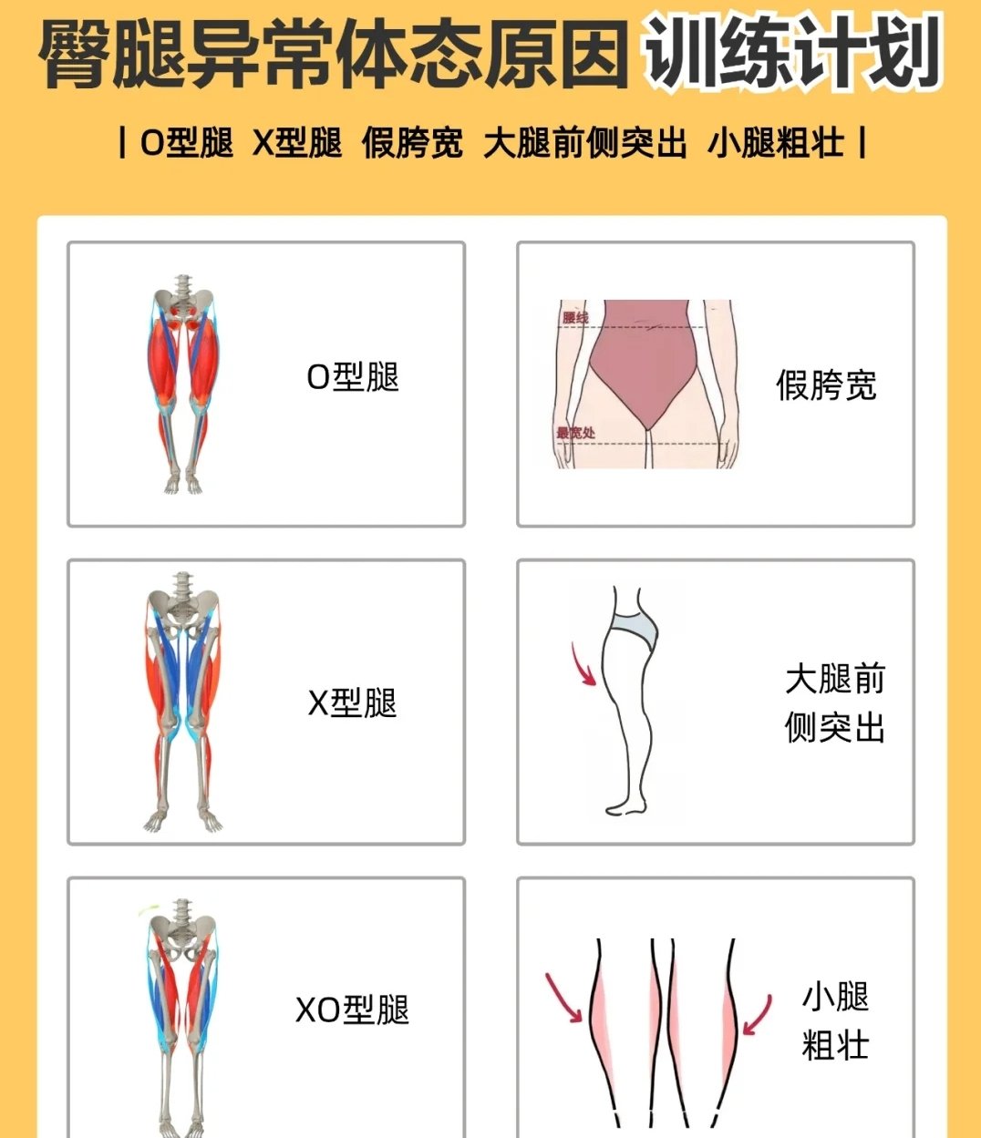 xo型腿矫正图解 最有效图片