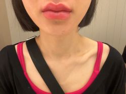 -深圳艺星医疗美容医院