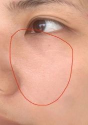 -东莞缔美美容医院